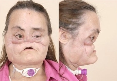 Connie after shooting